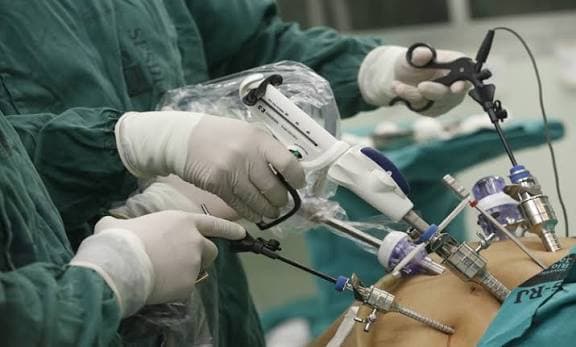 Fertility Laparoscopy: What to Expect Before, During, and After
