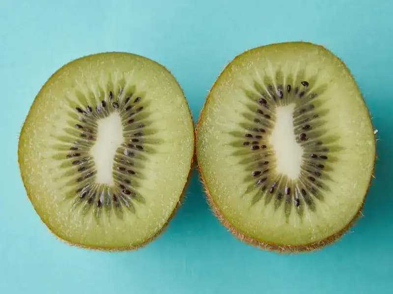 10 Health Benefits of Kiwi Fruit You Should Know