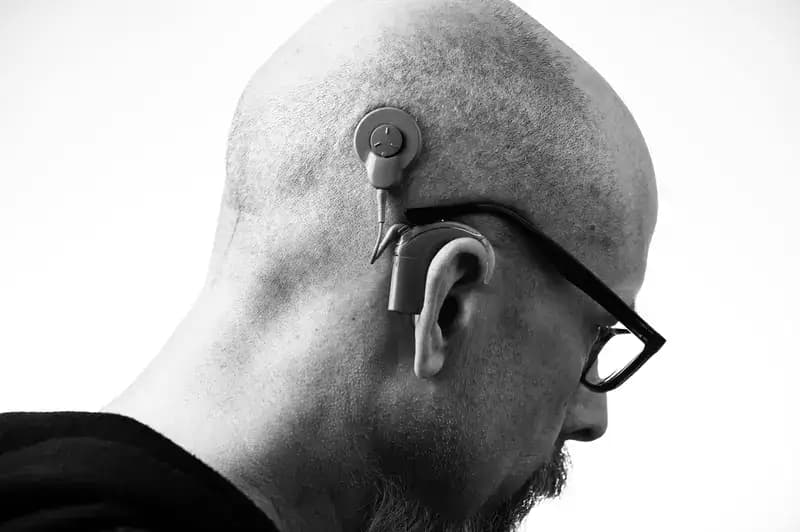 Hearing Loss: Causes, Types, Solutions, and Real-Life Impacts