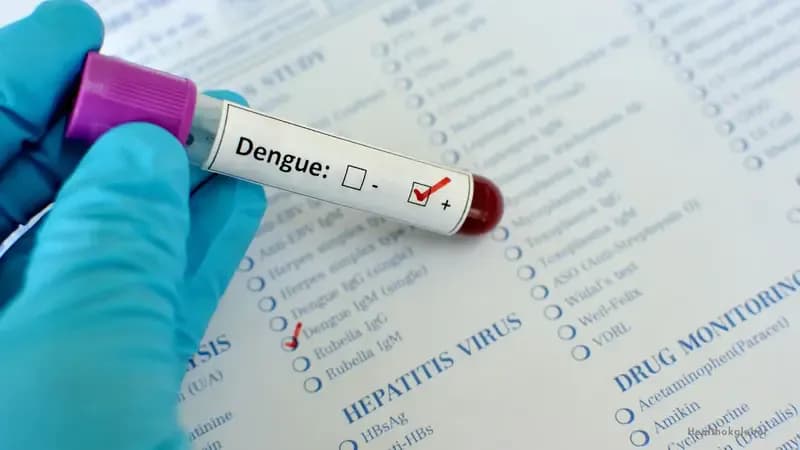 Dengue NS1 Test: What It Detects, When to Get It, and What Results Mean