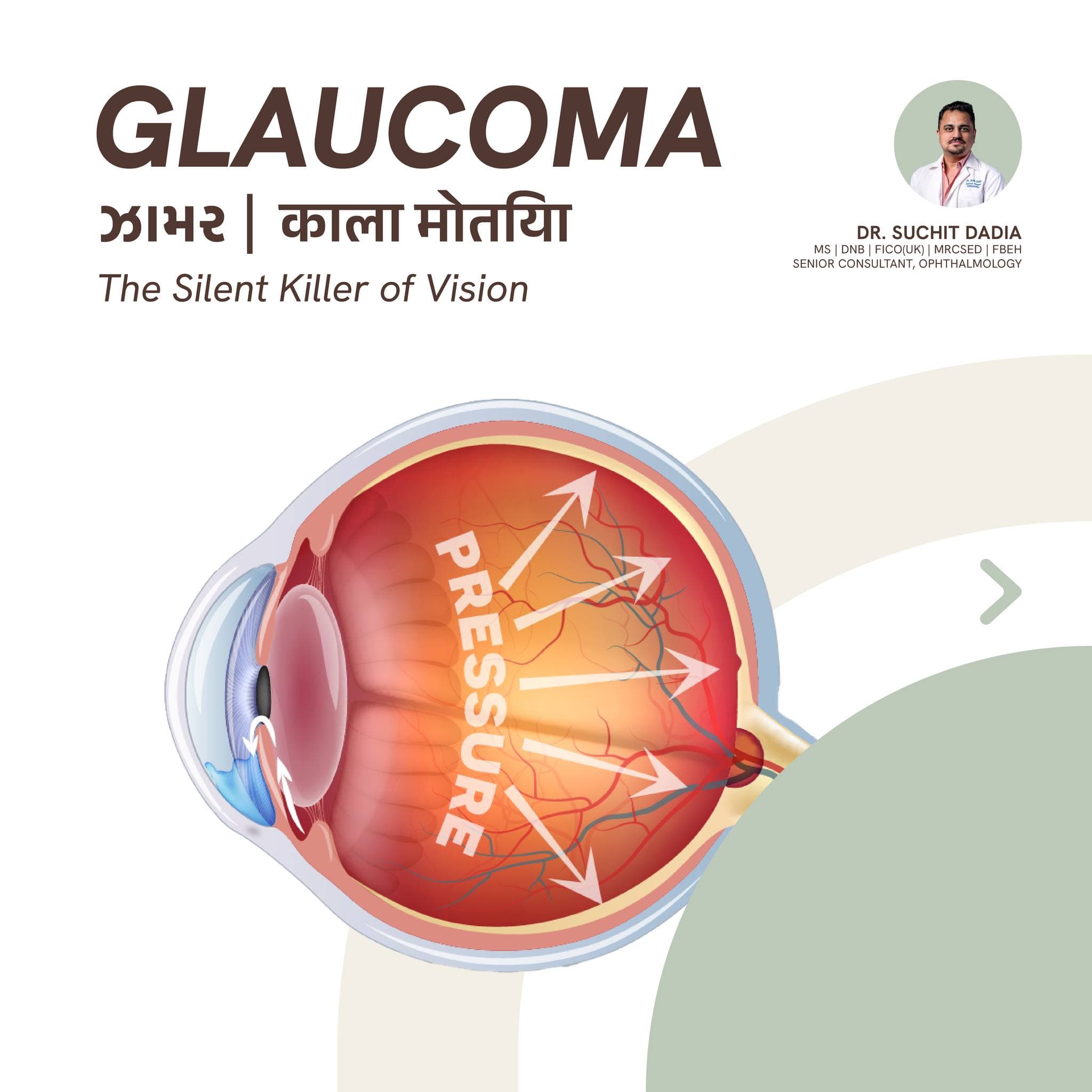 Glaucoma Awareness: Protect Your Sight Early