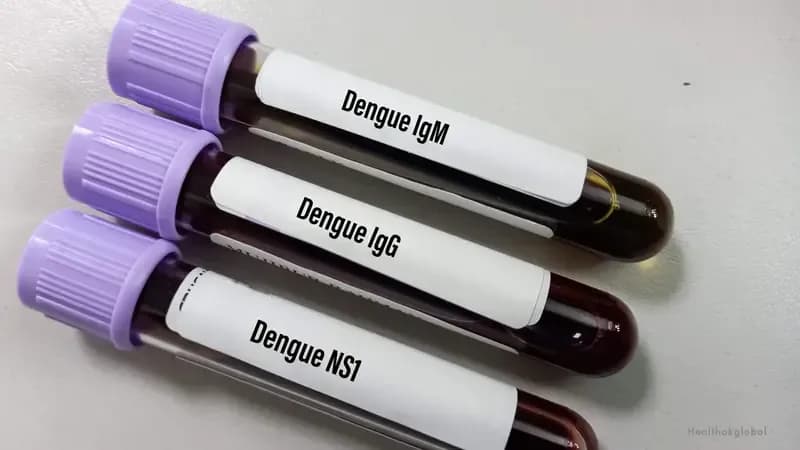 NS1 Antigen Test for Dengue: How the Test Works and What It Detects