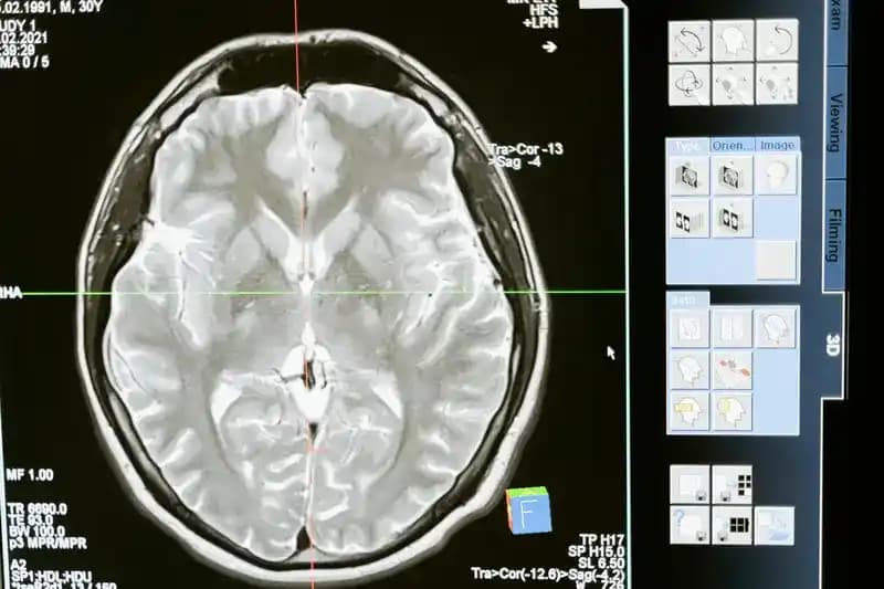 Neurological Disorders in Elders: Comprehensive Insights & Supportive Care