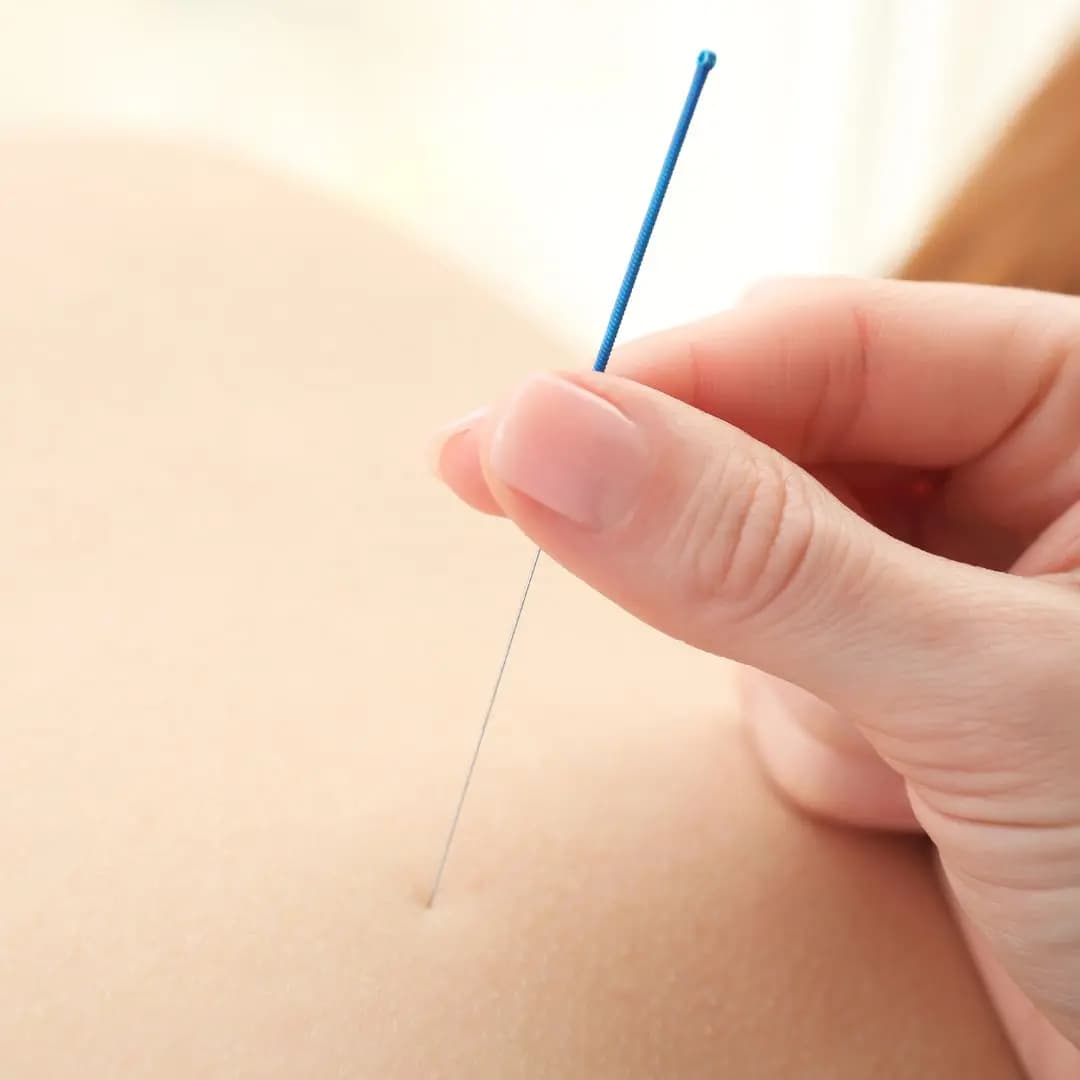Acupressure Points to Relieve Constipation Fast