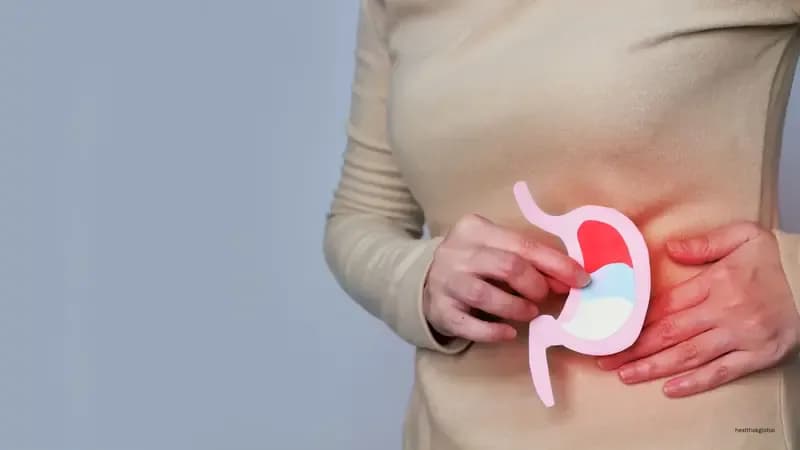 Comprehensive Nursing Management of Peptic Ulcer