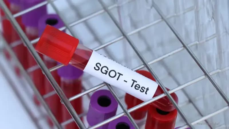 Understanding SGOT Normal Range: Importance and Implications for Health