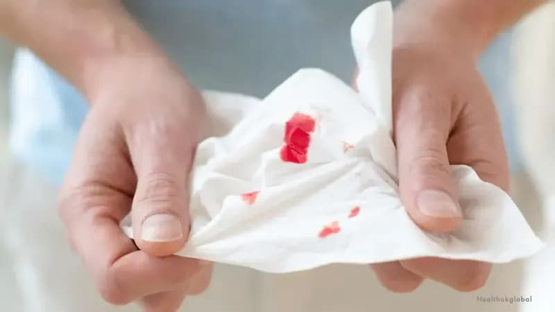 Bleeding Time Test – What It Measures & Importance