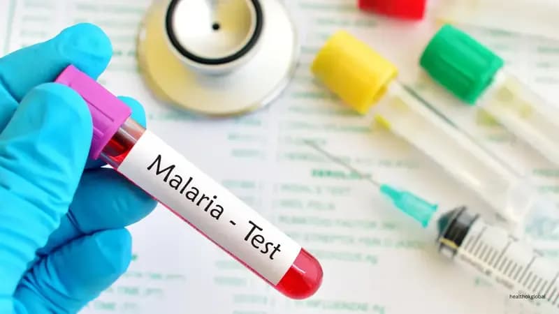 Malaria Testing in India: Which Test, When to Get It, and What Results Mean
