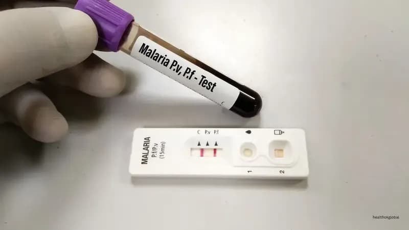 Malaria Test Kits (RDT): What They Detect, How Accurate, and When to Use One