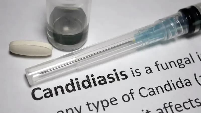 Mucocutaneous Candidiasis: Symptoms, Causes, and Treatment