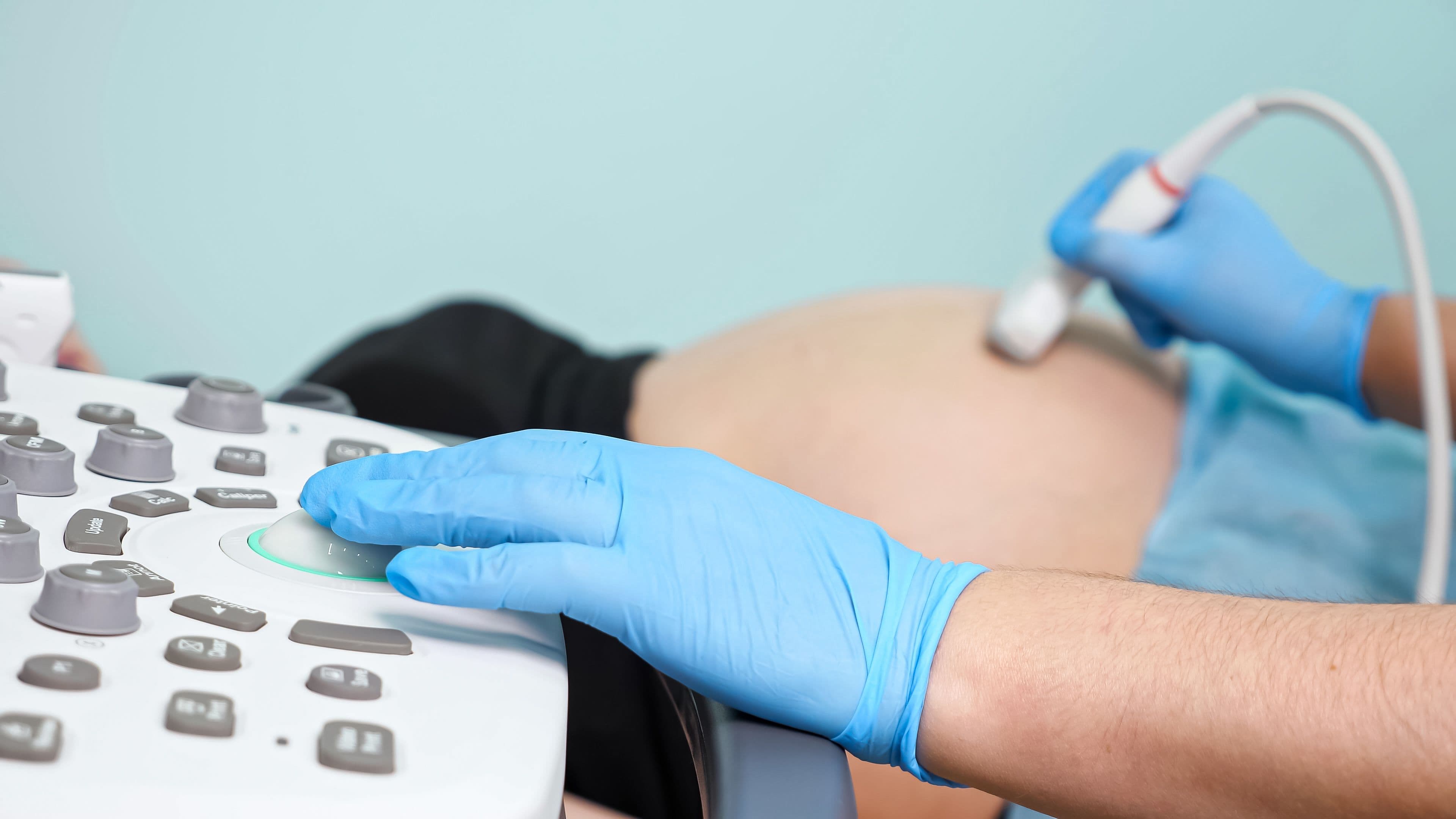 Benefits and Risks of Ultrasound Scan During Pregnancy